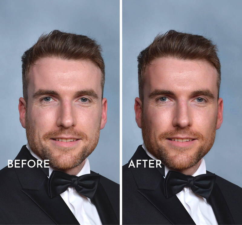 Contouring Lighting - 1