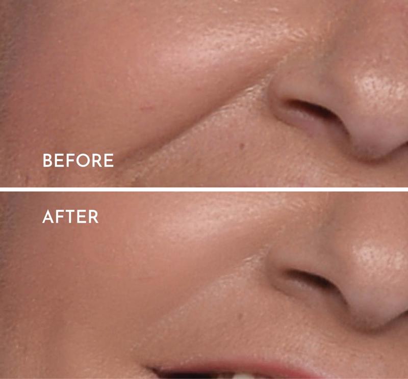 Wrinkle reduction - 2