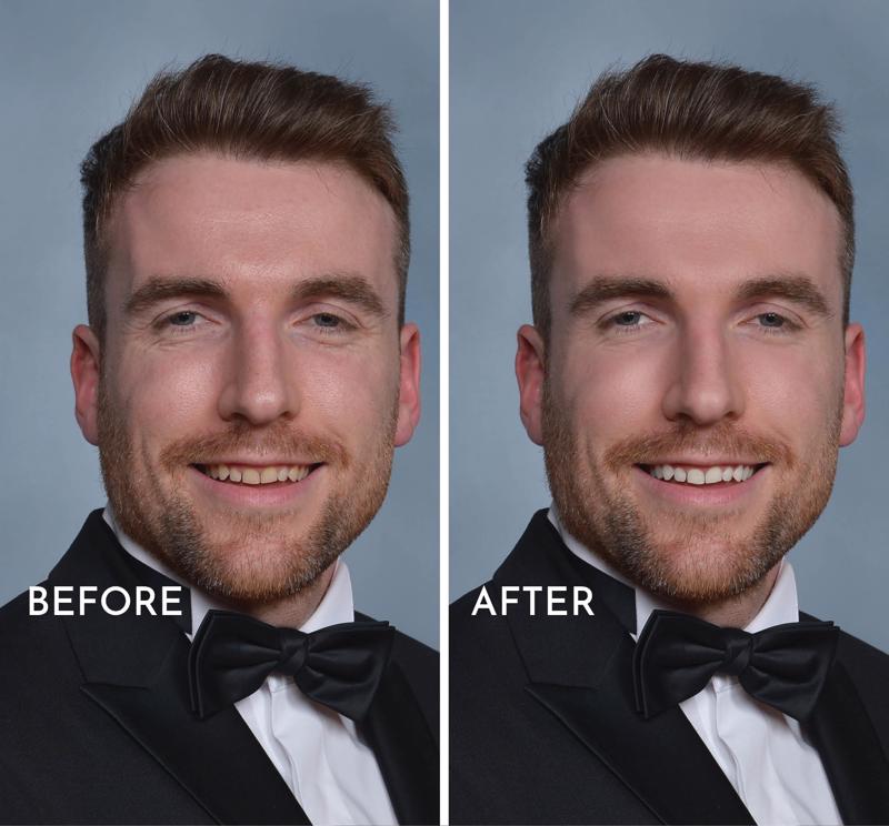 Photo Editing Bundle - 2