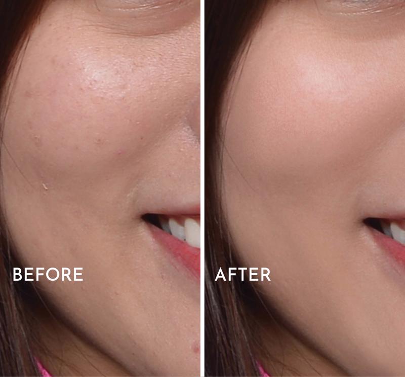 Smooth Complexion - 1