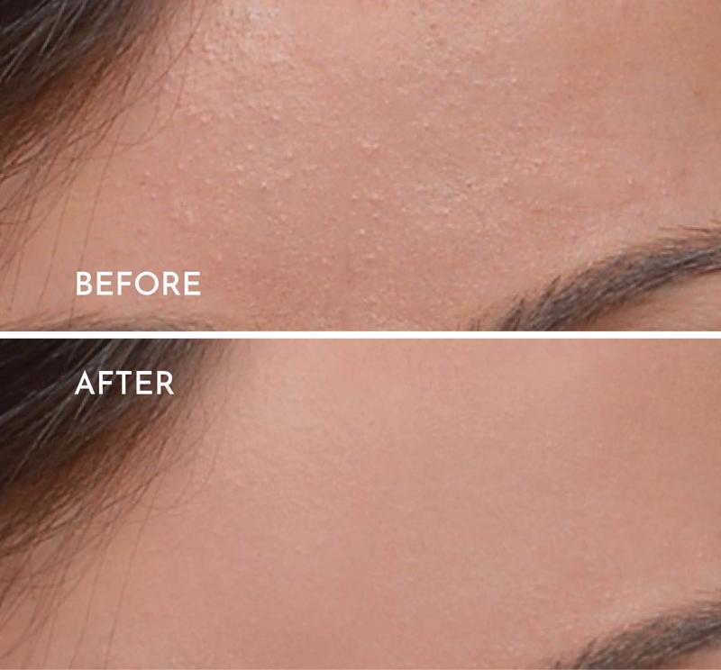 Smooth Complexion - 2