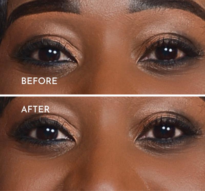 Eye Brightening - 1