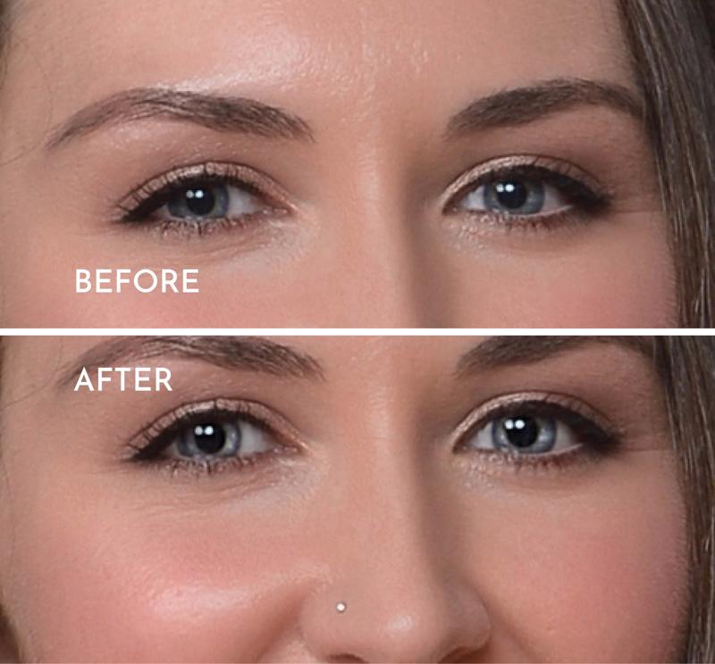 Eye Brightening - 2